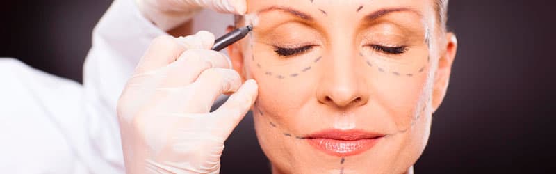 O que é a mentoplastia e quem deve fazer?